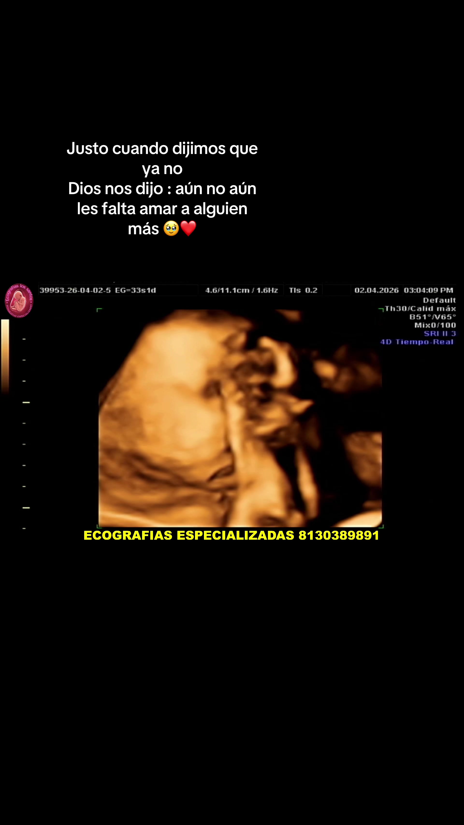 @Melany Andrade