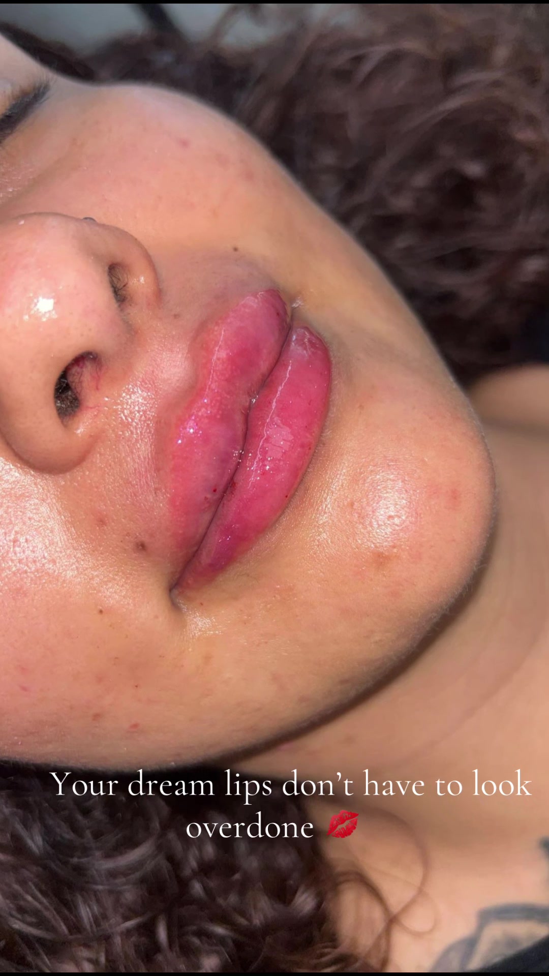 @injectormami