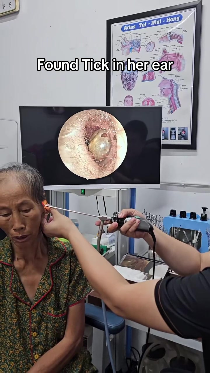 @Satisfying Ear Cleaning Videos
