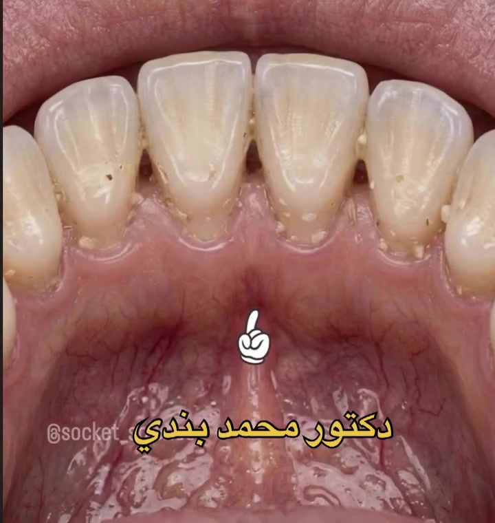 @Dr.Mohammed.Bandi
