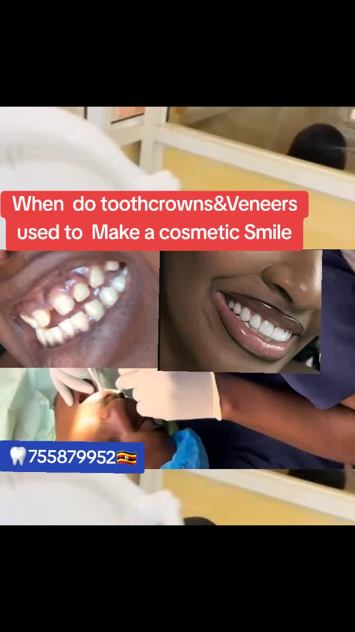 @Allianz Dental studio🦷🦷🇺🇬