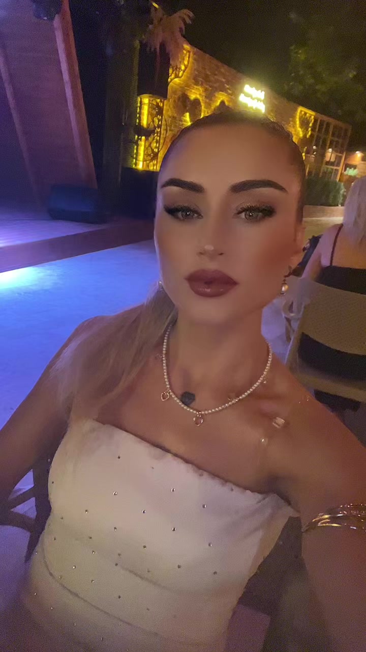 @KİWİ GOZLUU