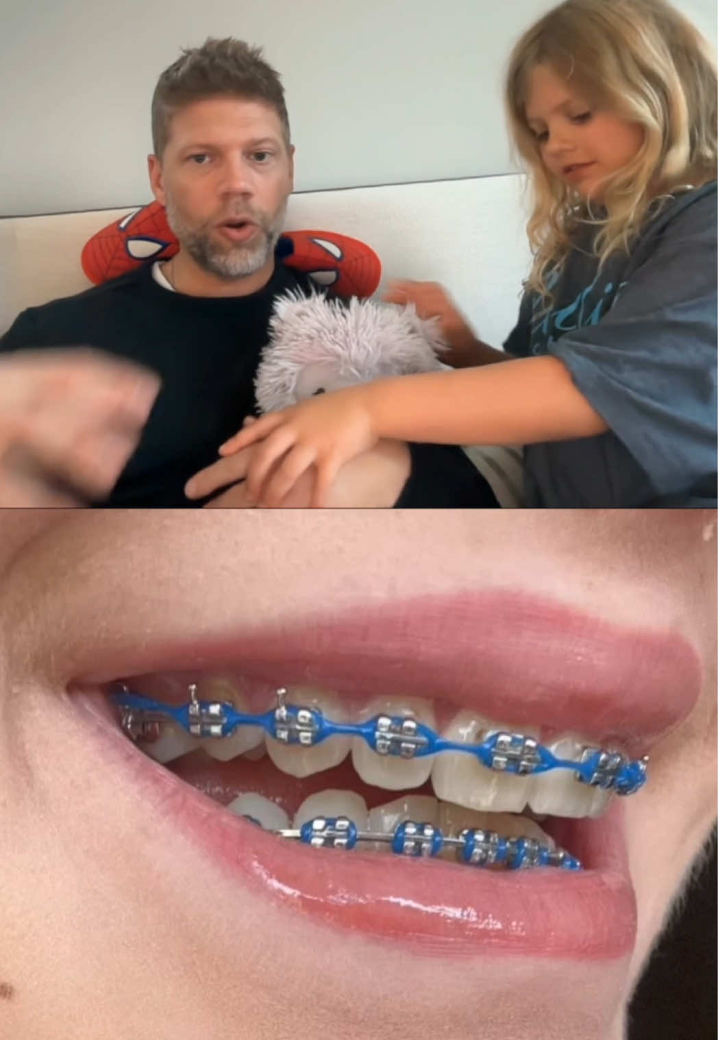 @The Braces Guy