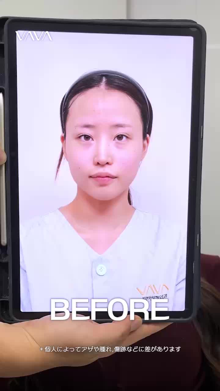 @VAVA美容整形外科