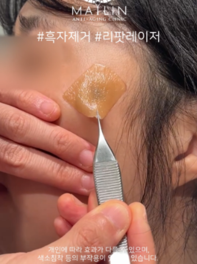 @메이린의원대구점