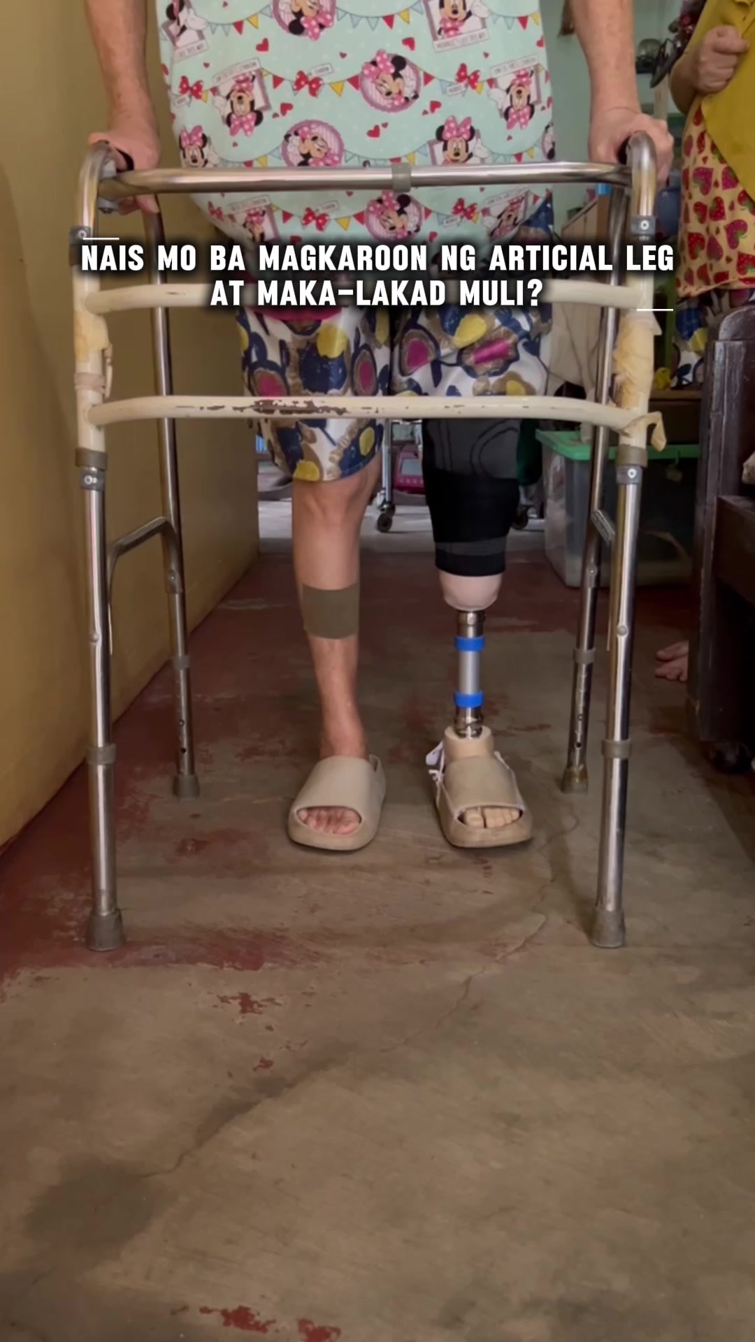 @Ogette Prosthetics & Orthotics