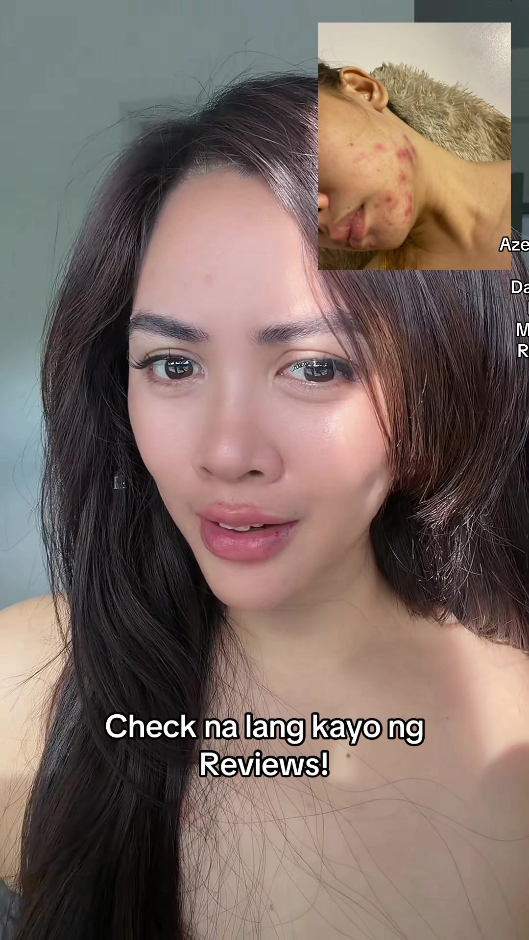 @Ally Feedback Ph