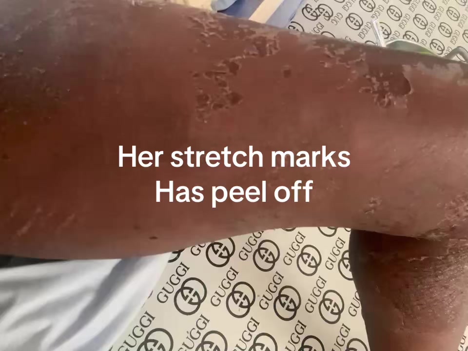 @@ Precious peeling soap