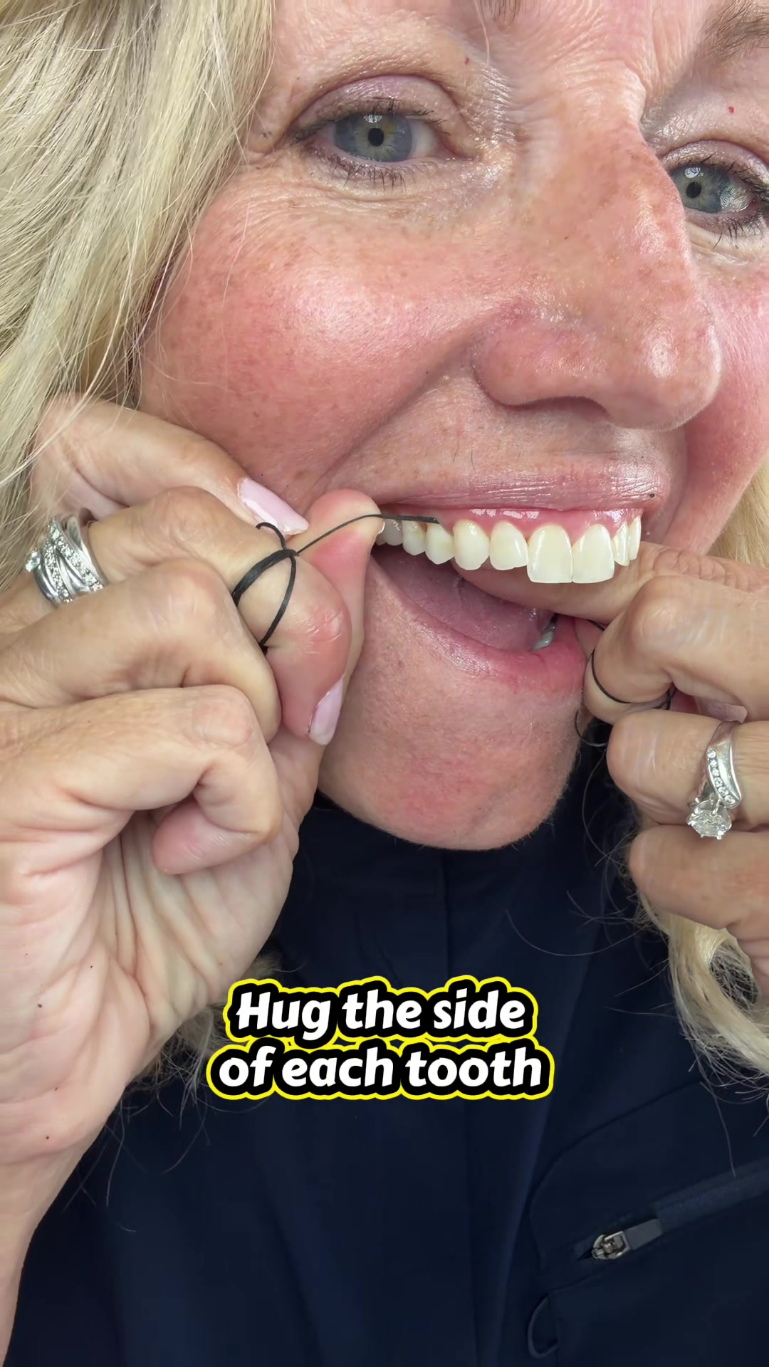 @openwiderdh