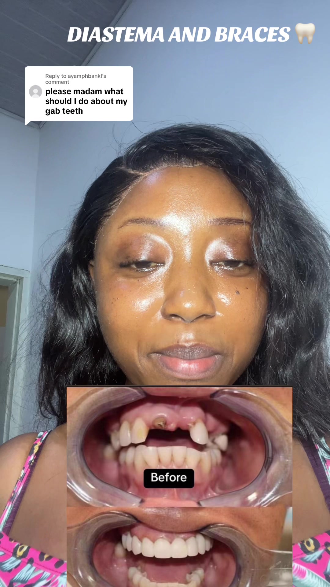 @NurseVivinelle_OralEducator🦷