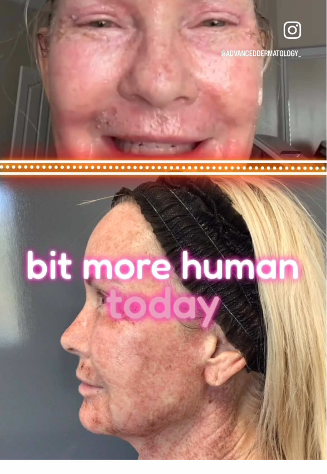 @AdvancedDermatology661