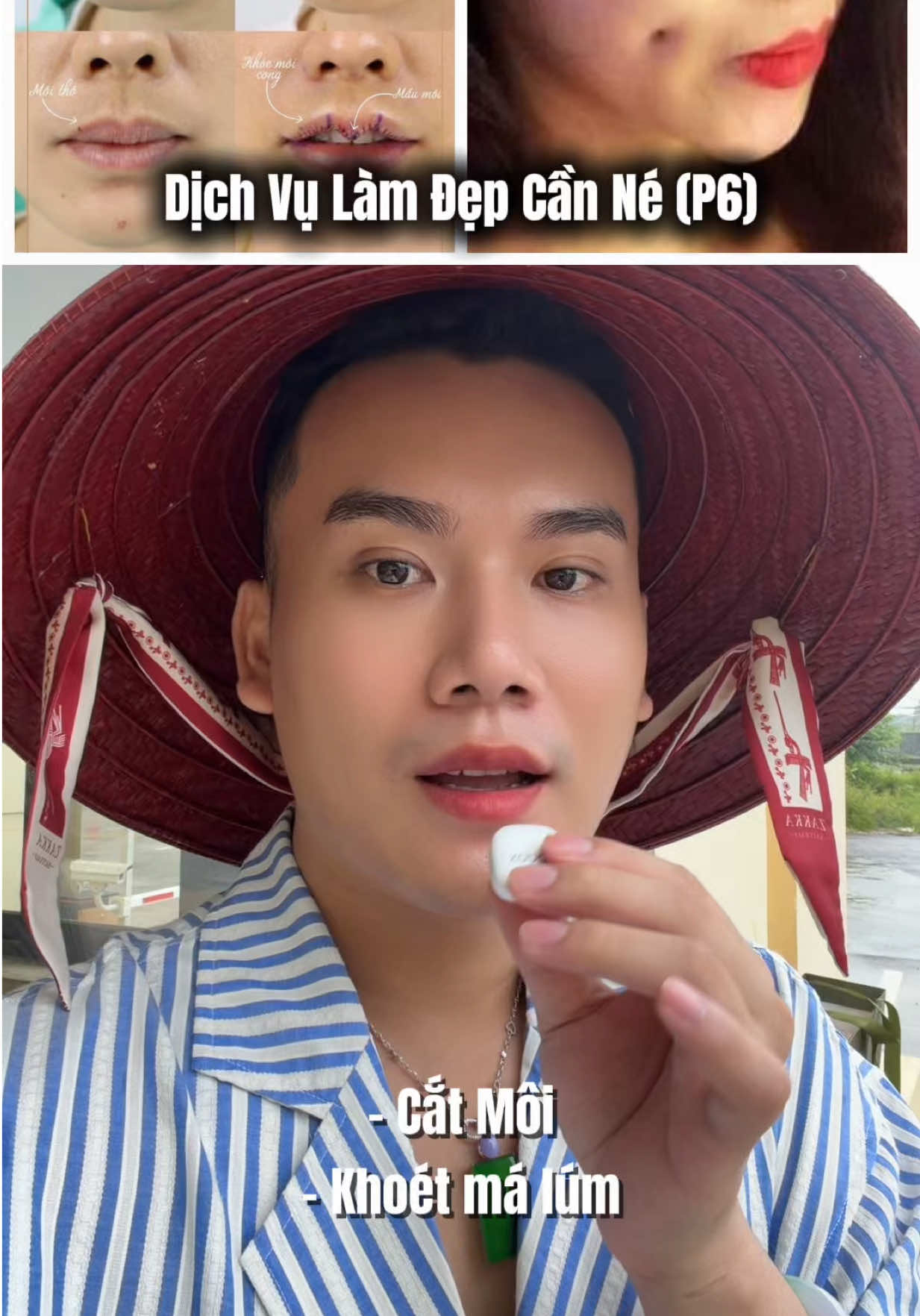 @Cô Học Chăm Da
