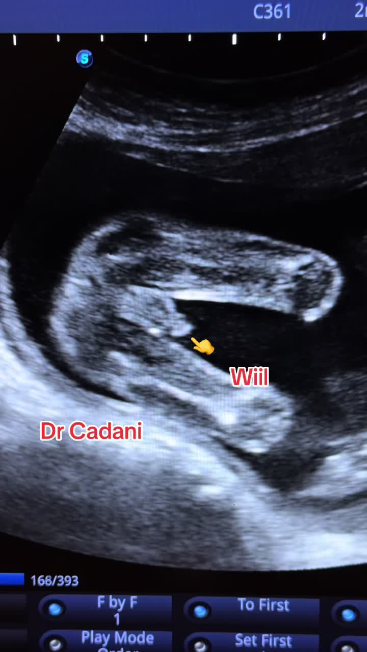 @Dr Cadani