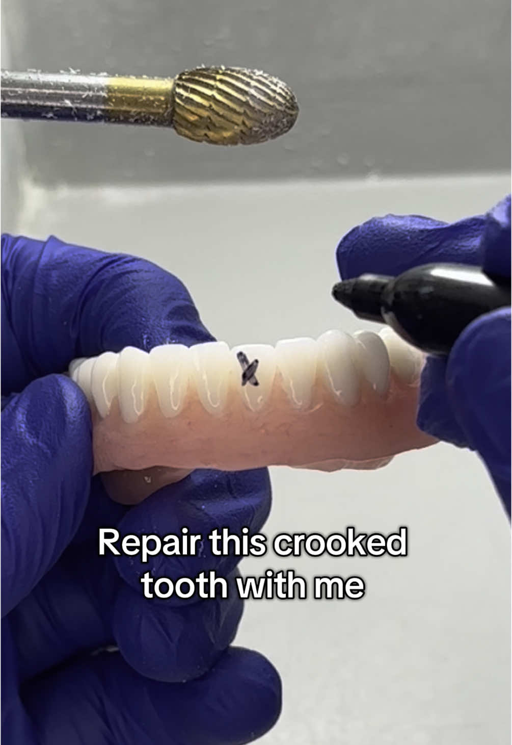 @Dental tech 🦷