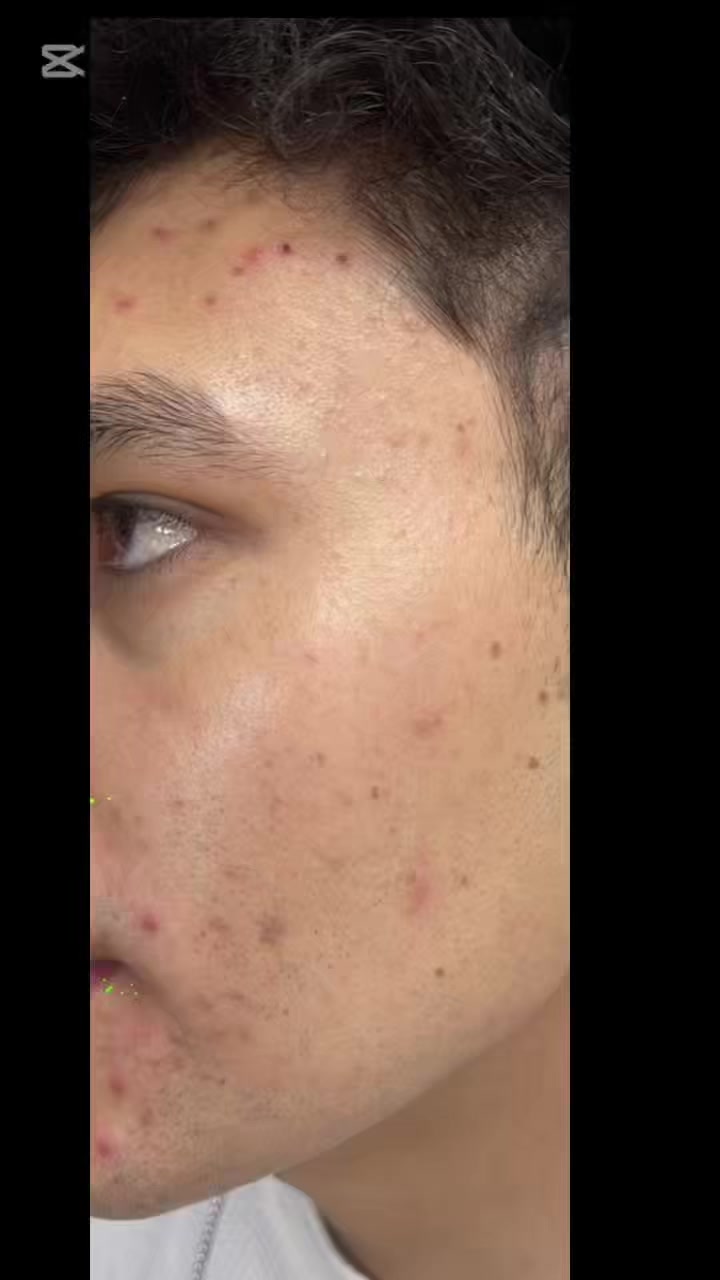 @Dra&ensp;Silvia&ensp;Lorena&ensp;FLORES&ensp;derma