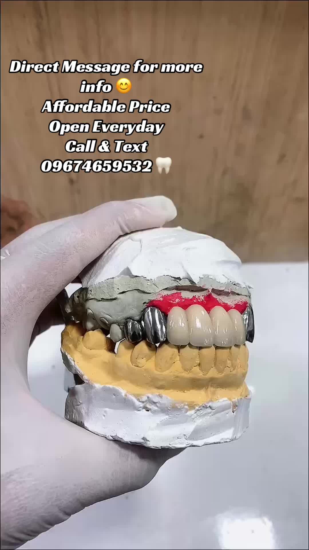 @Jobert affordable denture 🦷