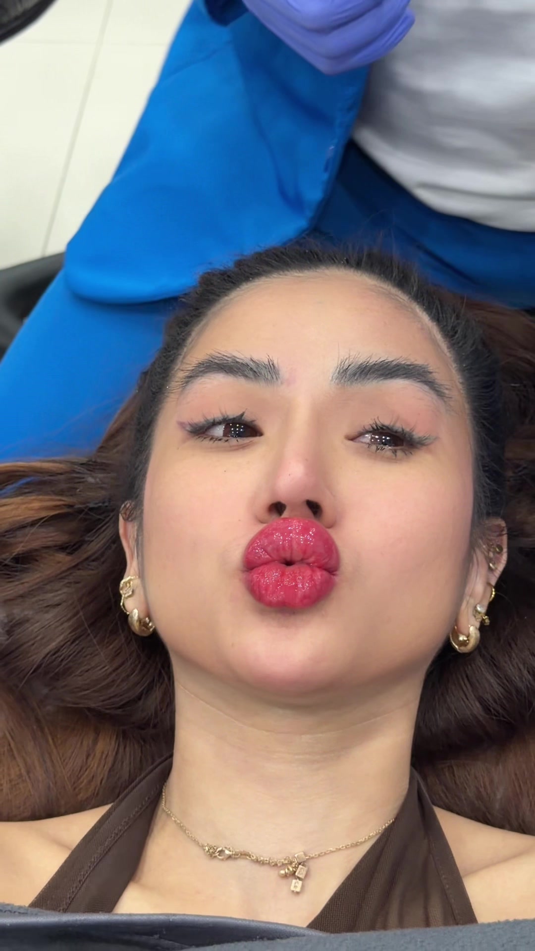 @vennyalberti165