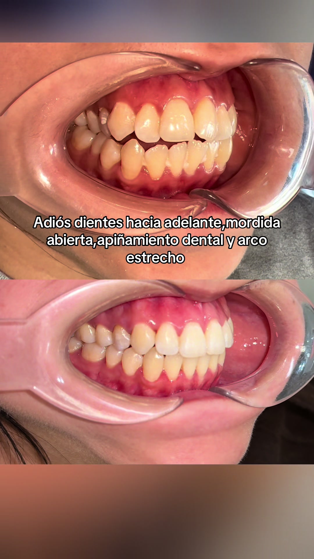 @DentikaBrackets