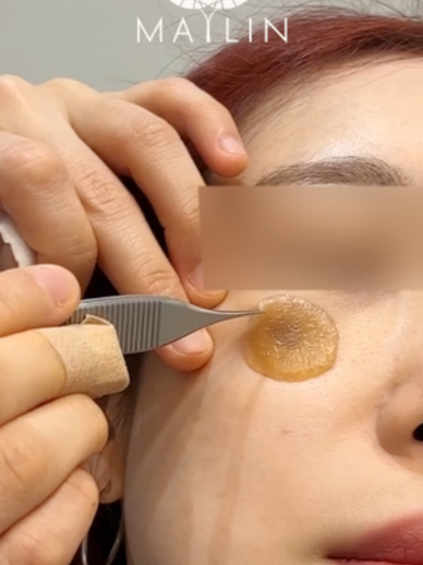 @메이린의원대구점