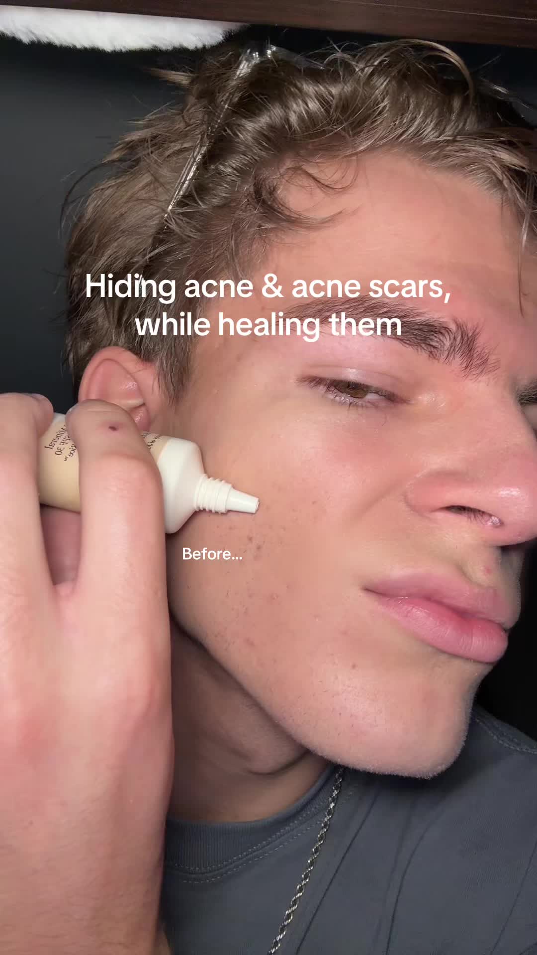 @Finn