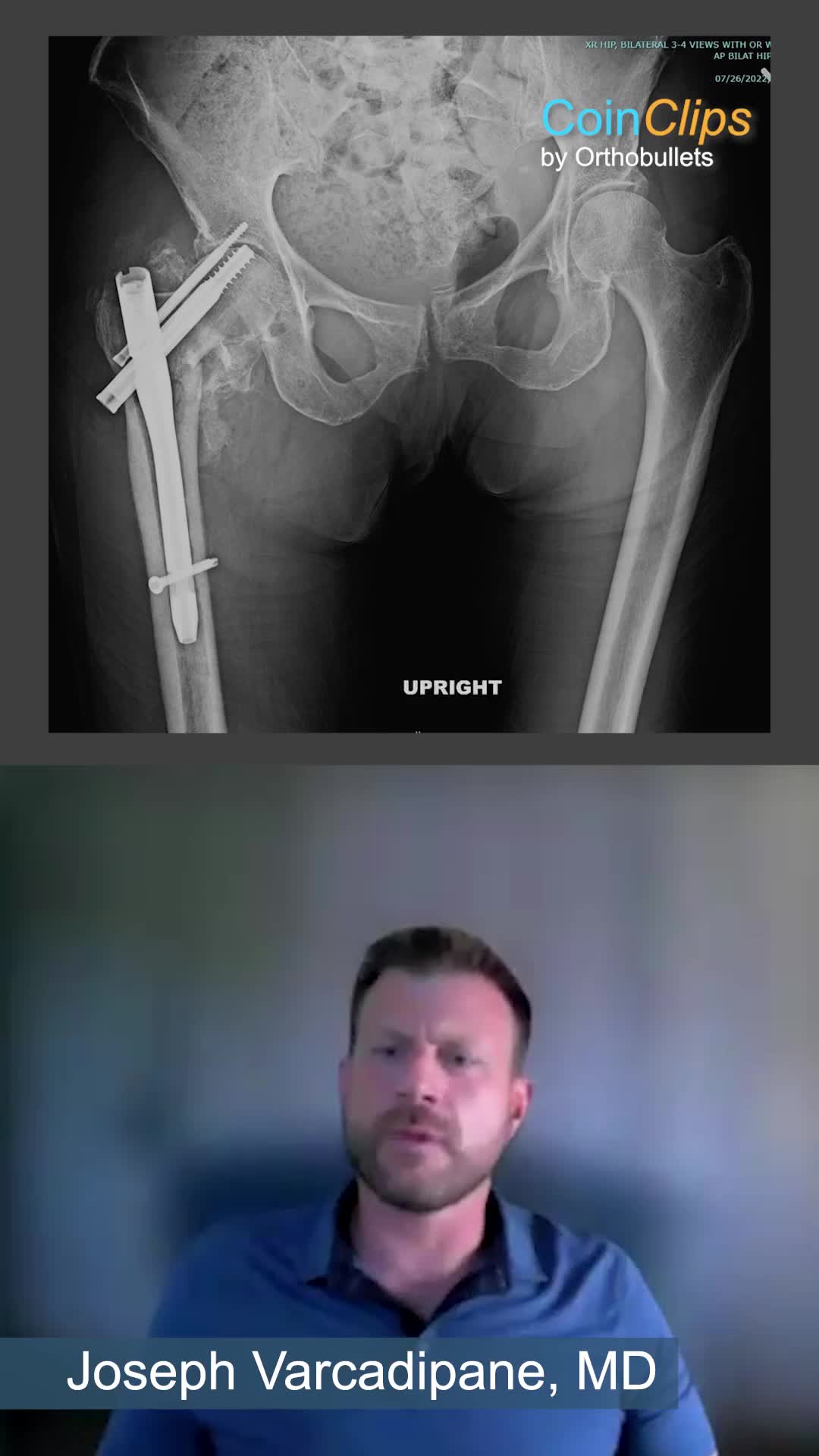@Orthobullets