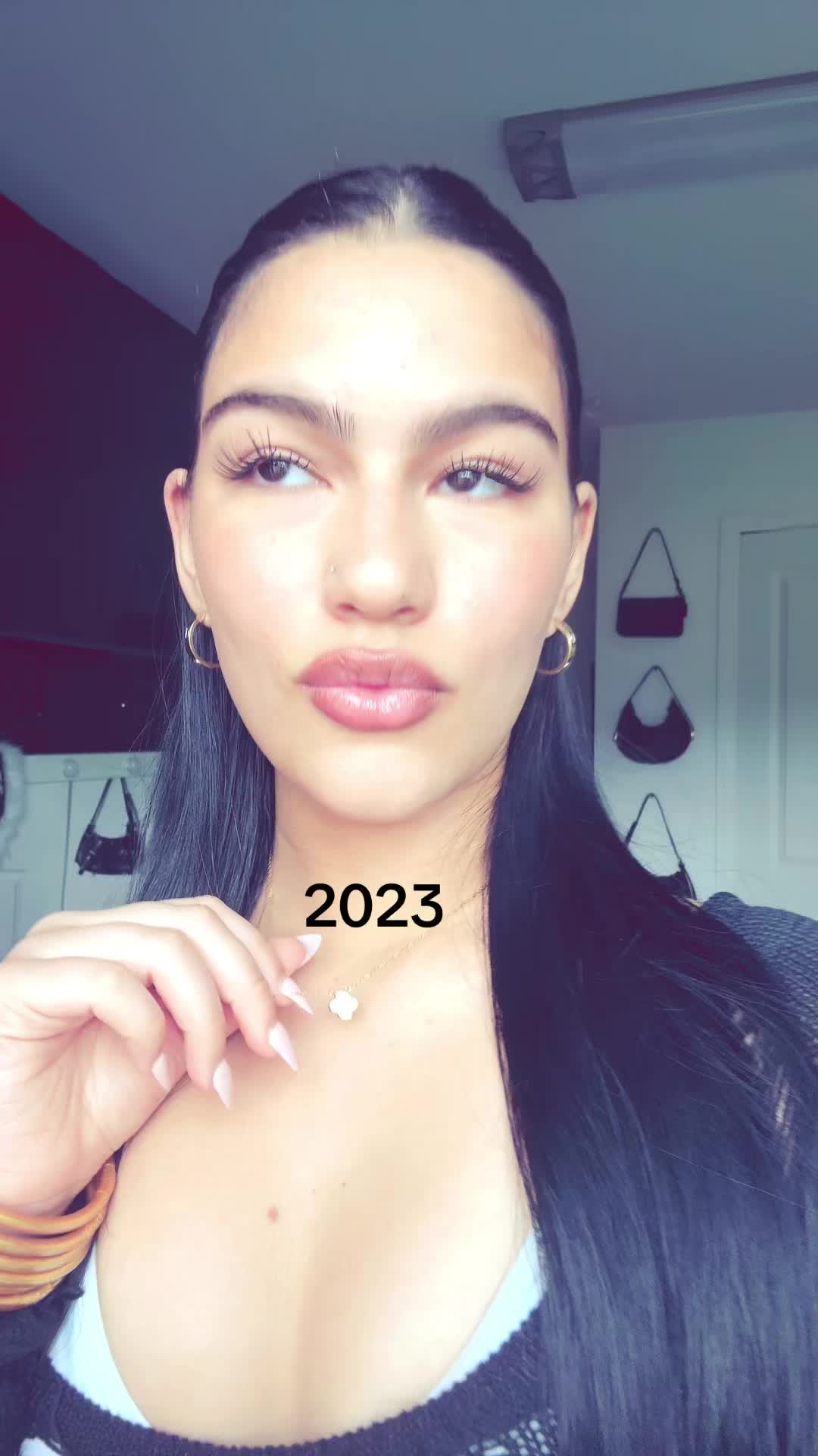 @Suset Aballe