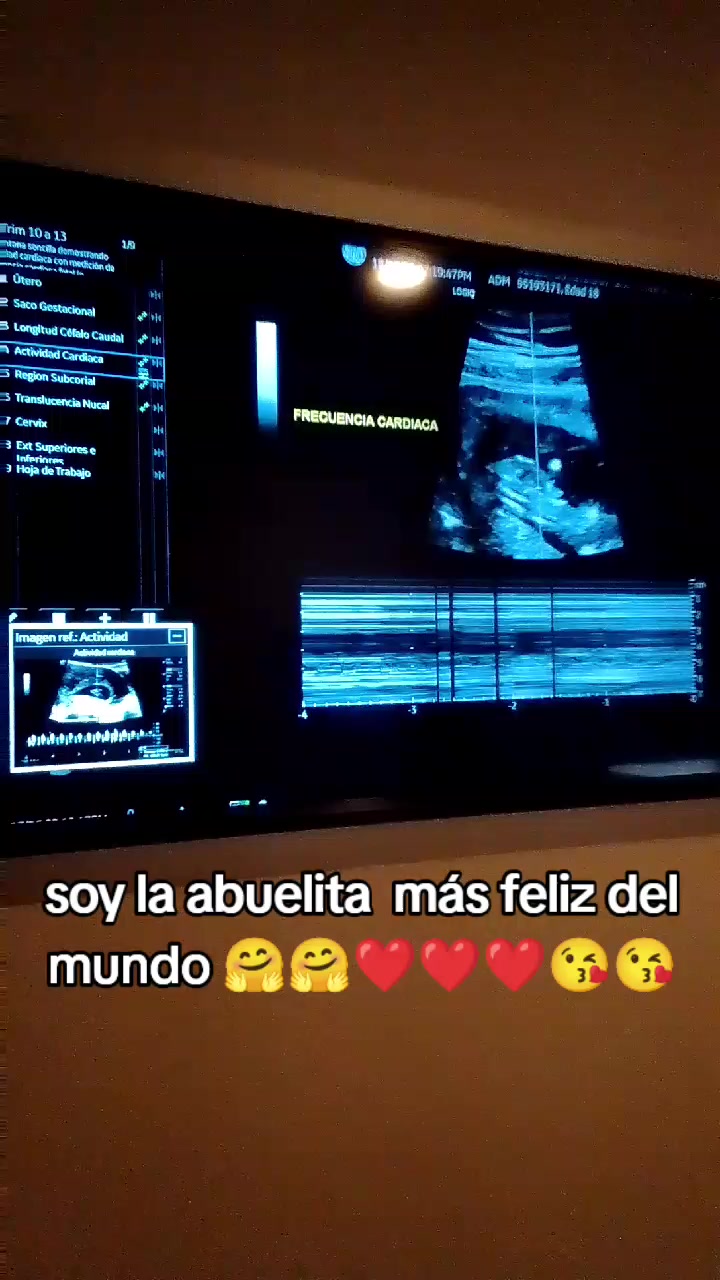 @Claudia Perez