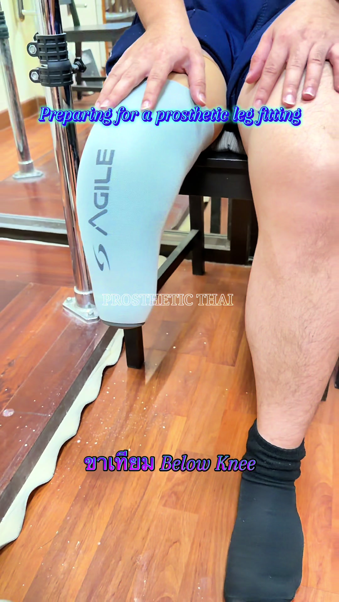 @คลินิกขาเทียม☎️089-6969502เอ็ม