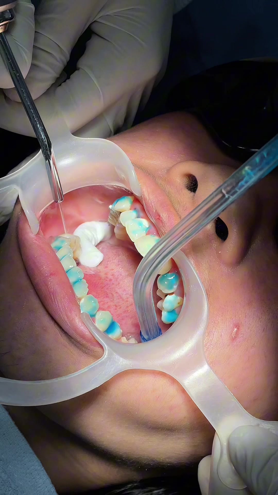 @BRIGHT SMILE DENTAL HOSPITAL