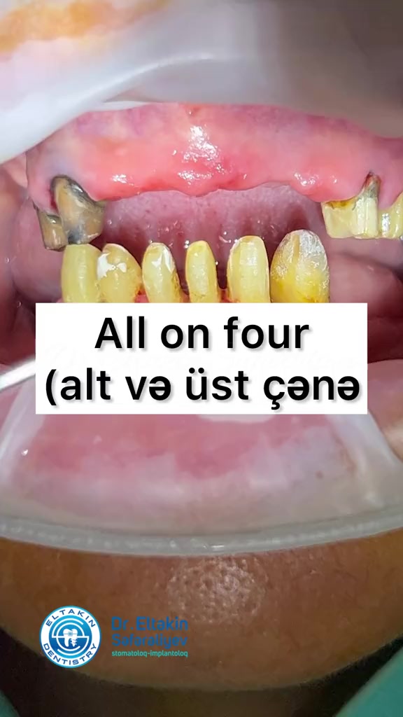 @eltakindentistry