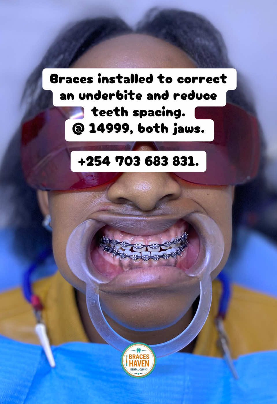@Braces Haven Nairobi Dental