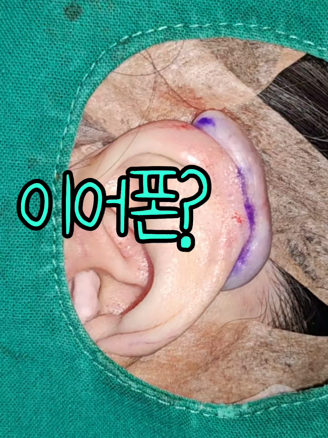 @아문성형외과