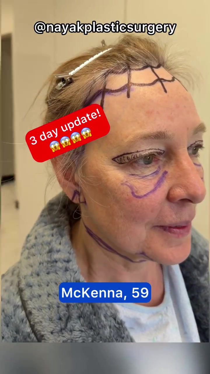 @NayakPlasticSurgery