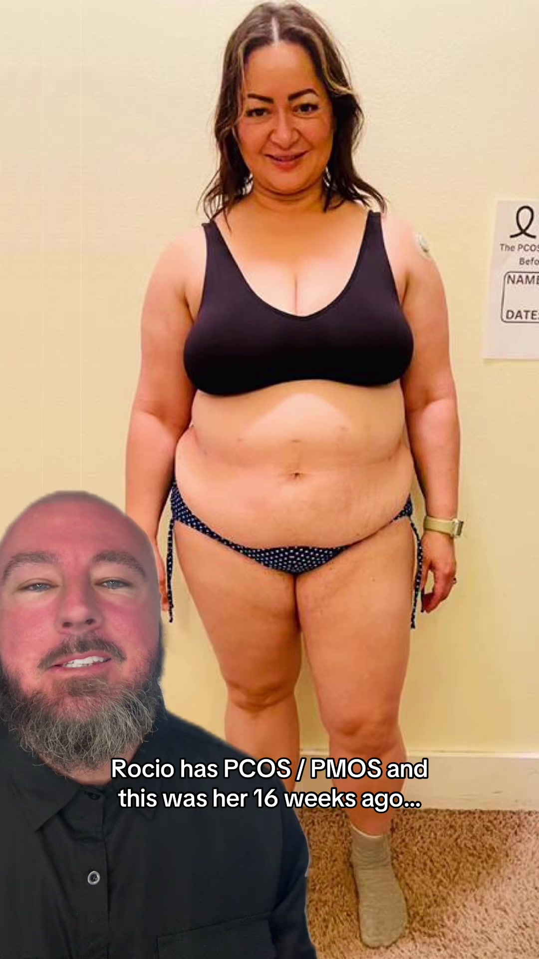 @Drew&ensp;Baird&ensp;|&ensp;the&ensp;PCOS&ensp;mentor