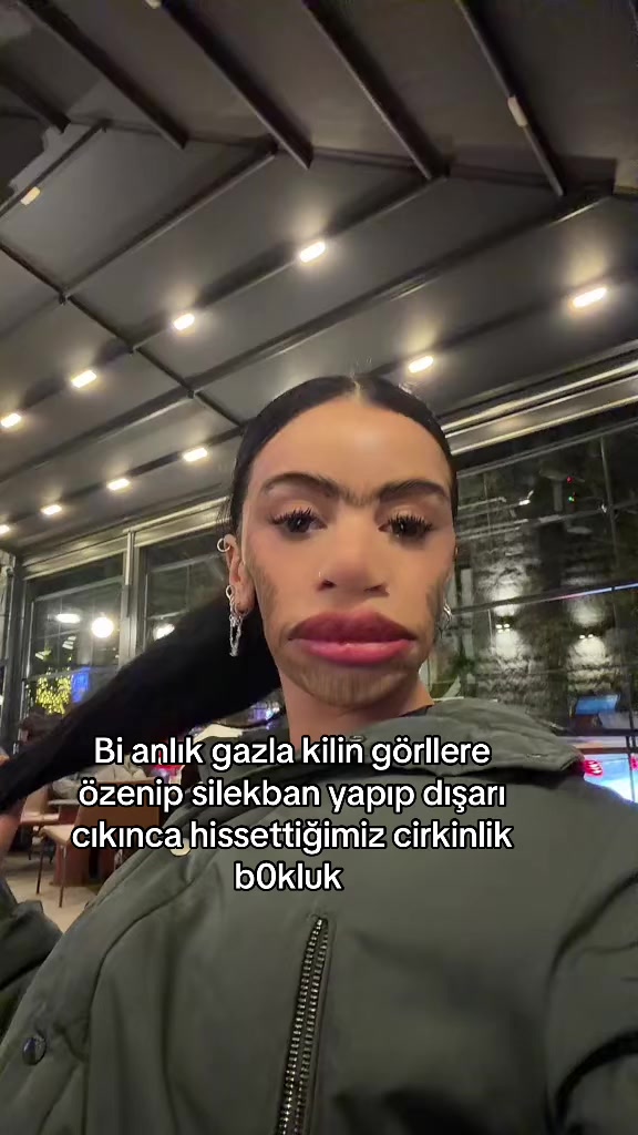 @Nnnr