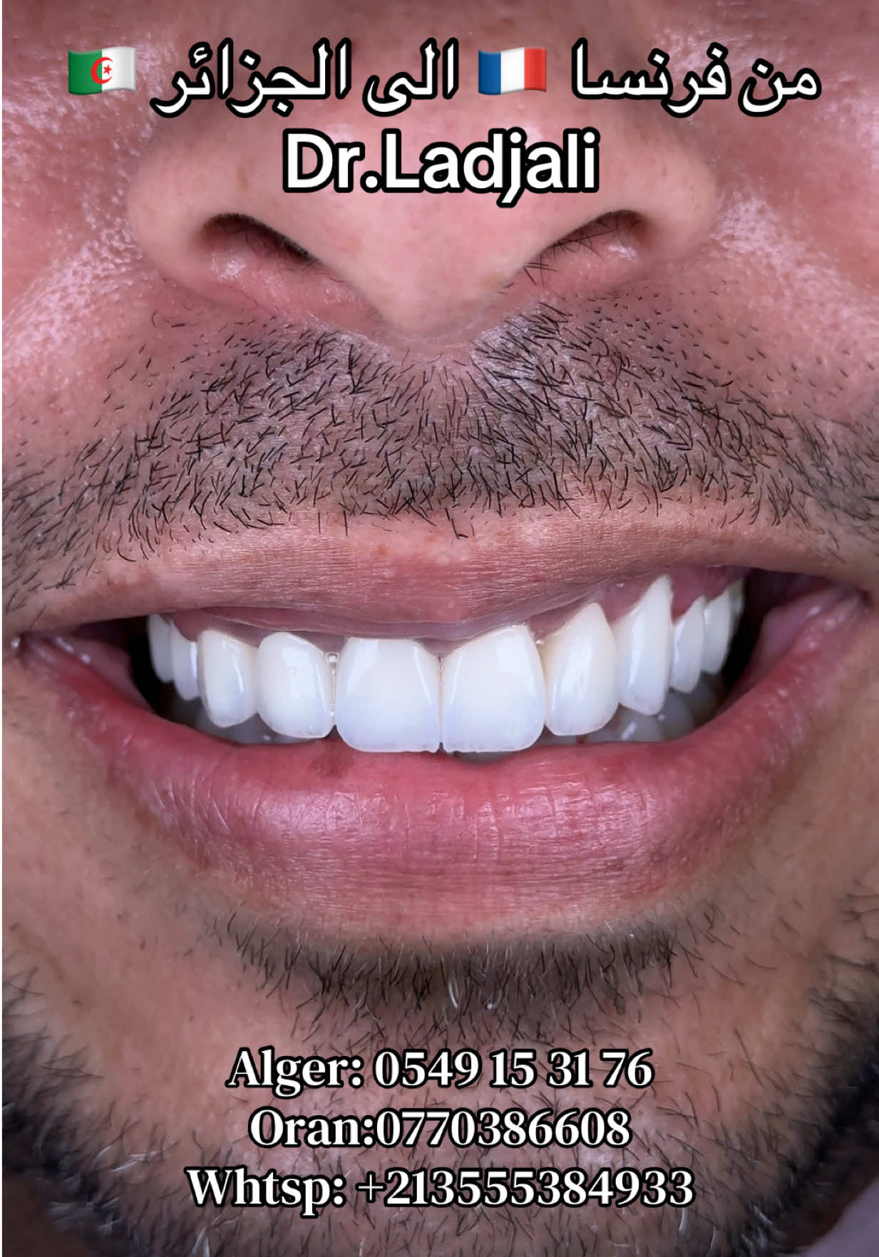 @Dr.ladjali