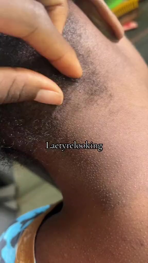@laetyrelooking2