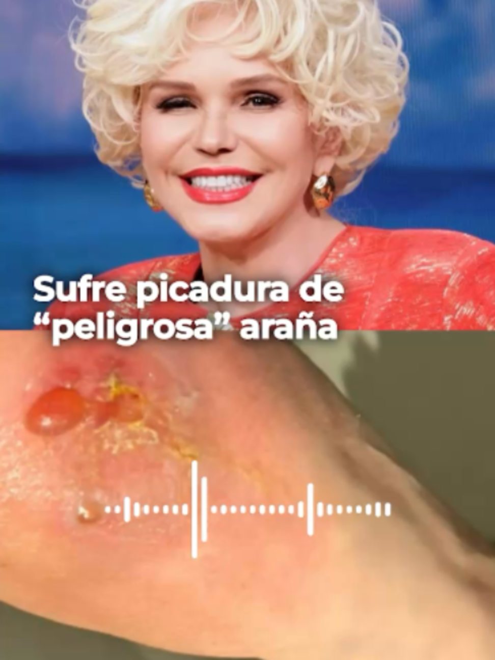 @Famosos