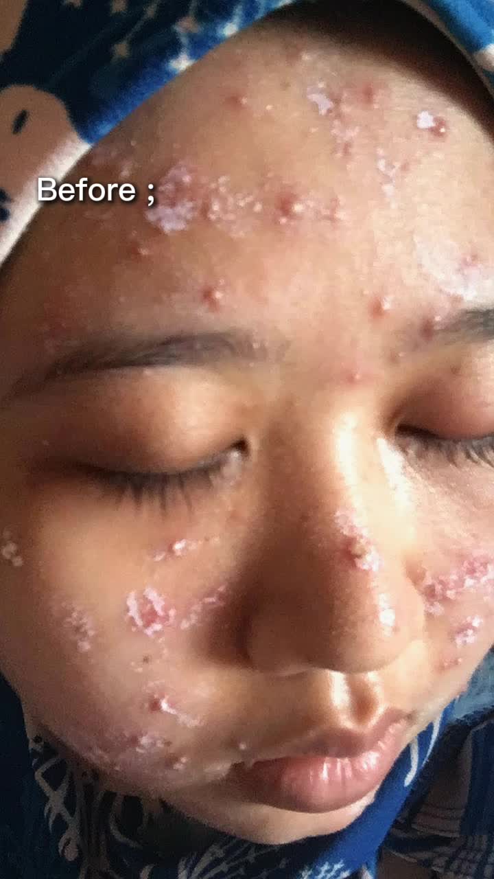@AINAANIDA