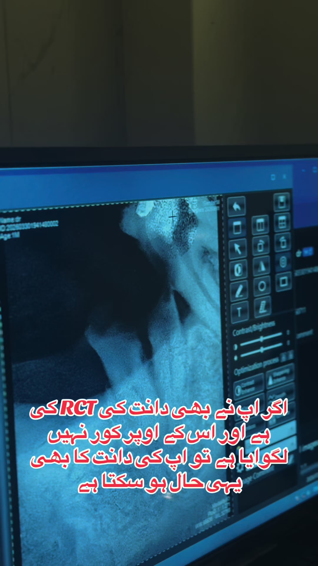 @Dr Hammad| Dental Surgeon