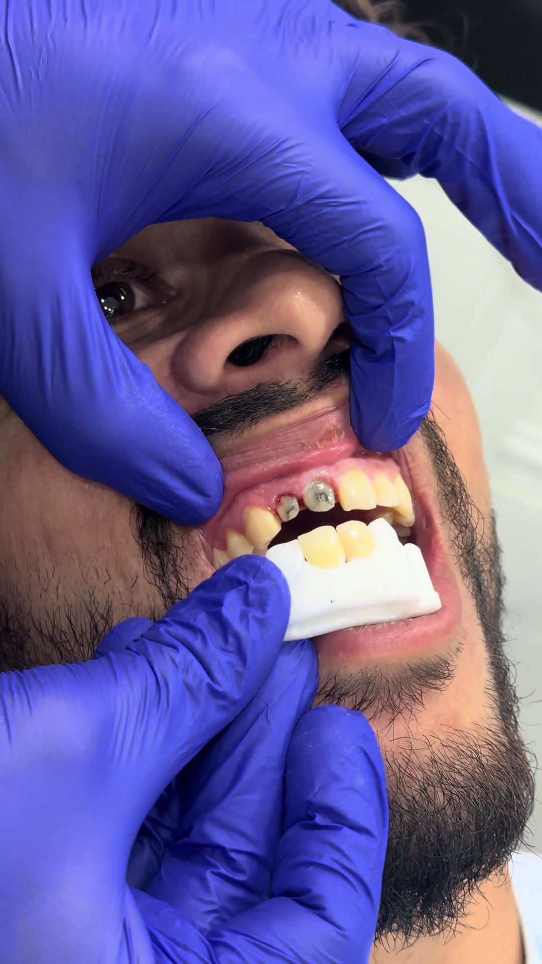@Numan Dental Clinic