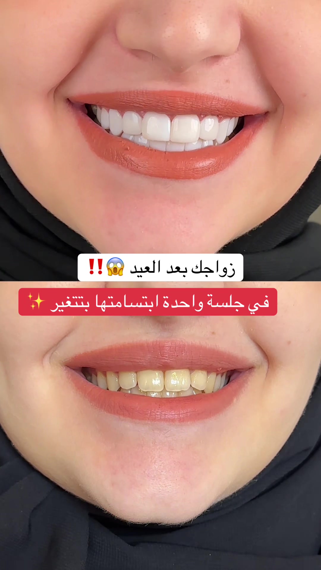 @Dr.lina_almasmoum