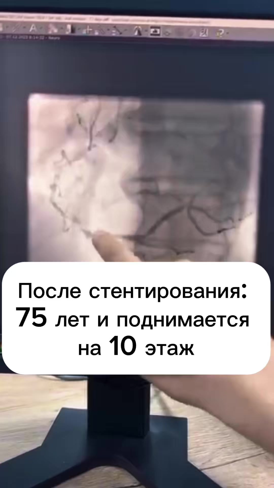 @Кардиолог / Аспет