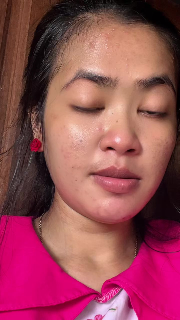 @លីណែត♥️😘🖐️