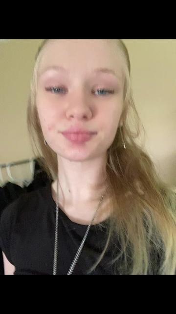 @lol