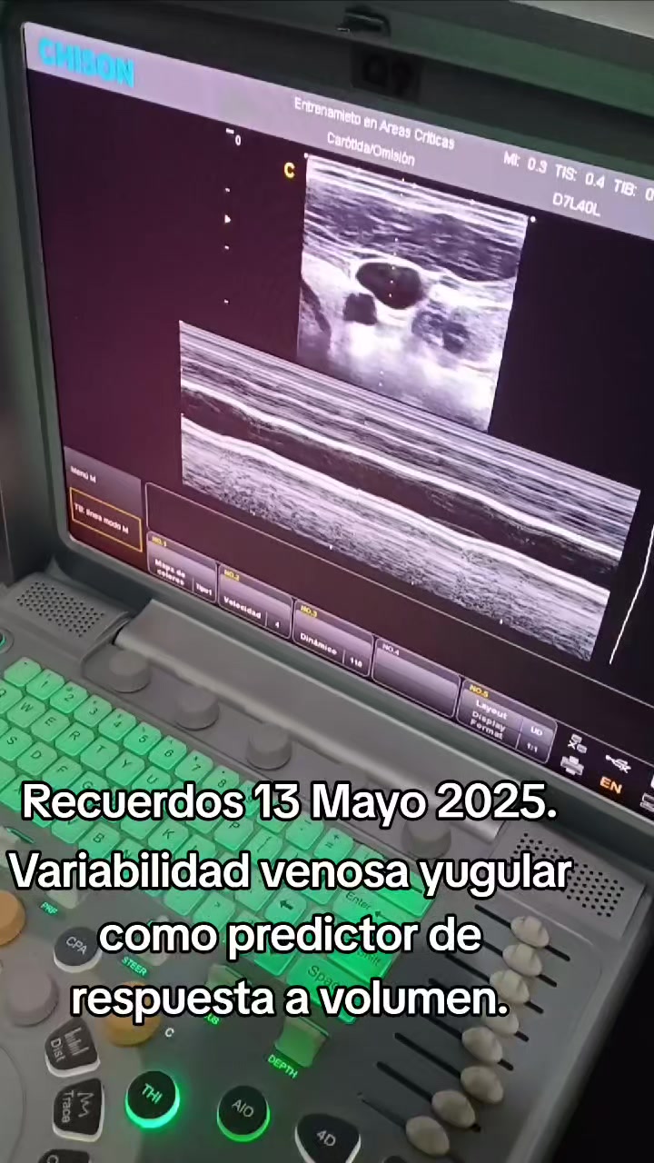 @Dr. Ajolote.