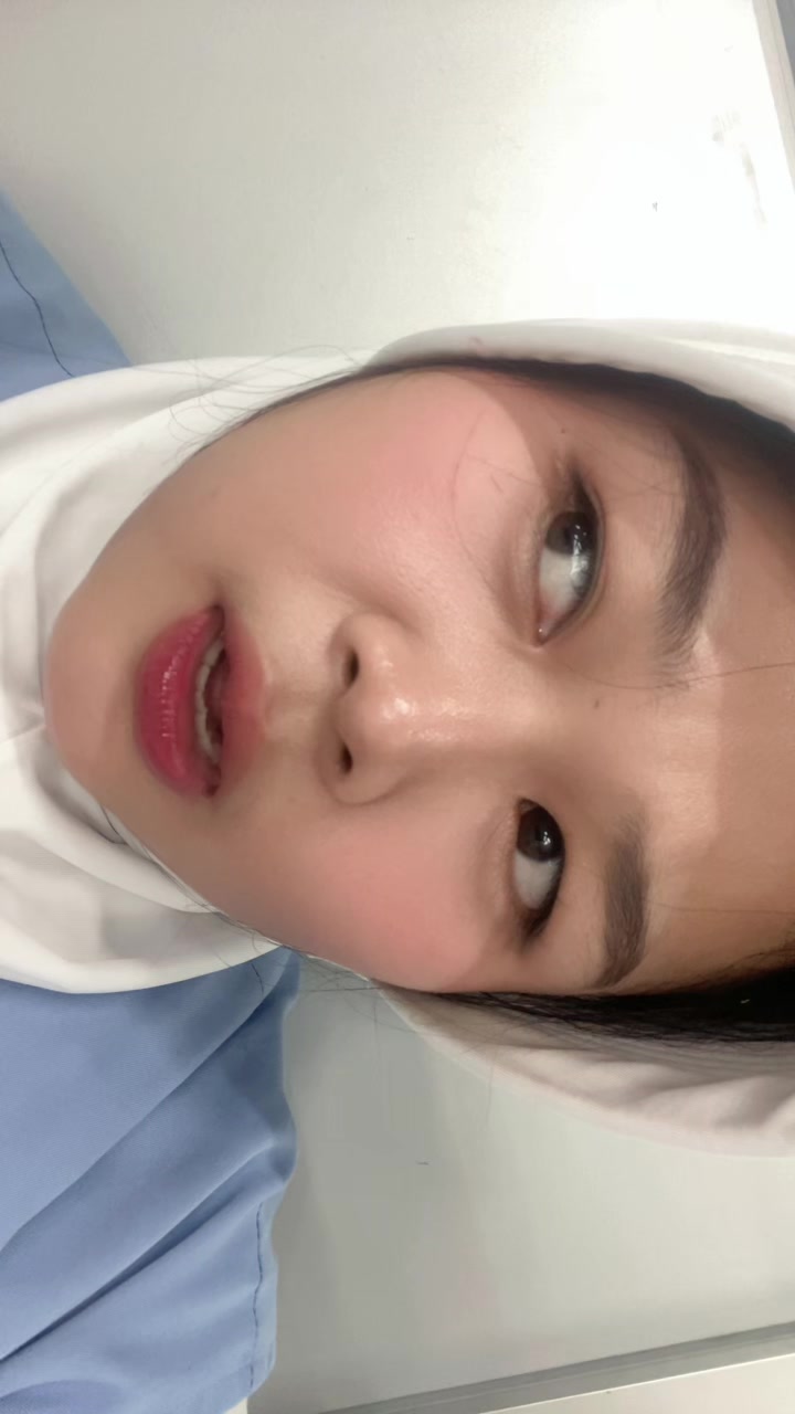 @mimoOom