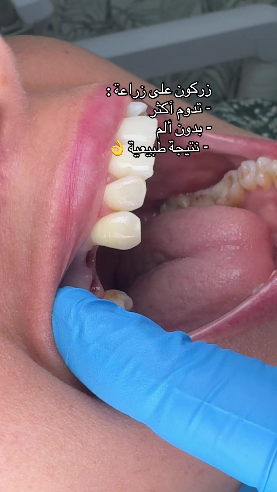 @GOSMILE ROUIBA🇩🇿