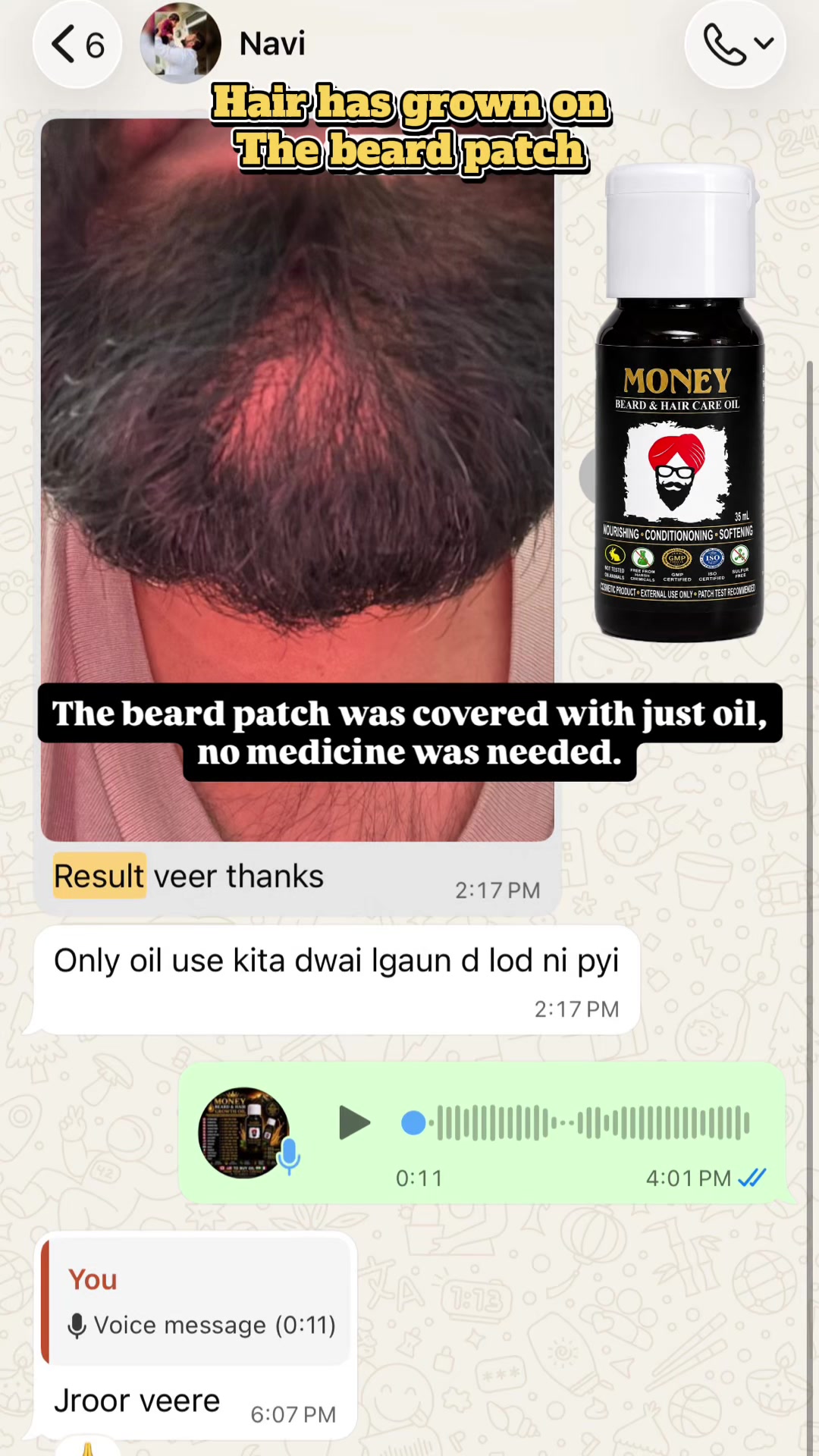 @money_beard_growthoil