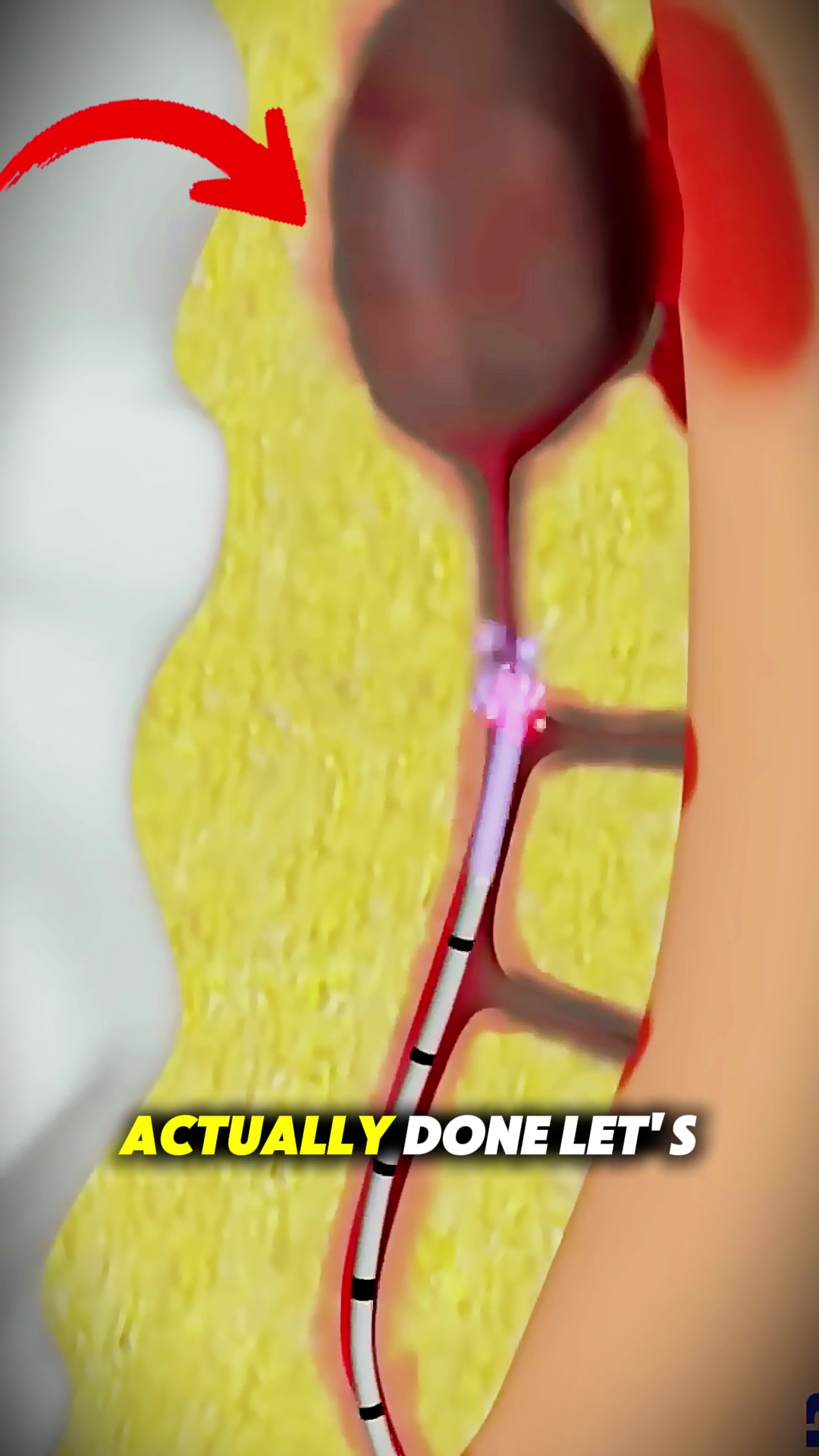 @Human 3D